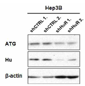 Hu 지속적 발현 억제 간암세포주의 ATG 발현억제