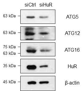 Hep3B 세포주에서 HuR 발현 감소에 의한 내재적 ATG5, ATG12, ATG16 발현 확인