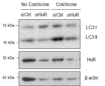 Hep3B 세포주에서 HuR 발현 감소에 따른 LC3 conversion 및 turn over 확인