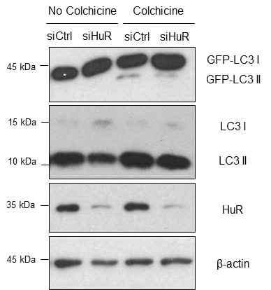 U2OS-GFP-LC3 세포주에서 HuR 발현 감소에 의한 GFP-LC3 및 내재적 LC3 발현 변화