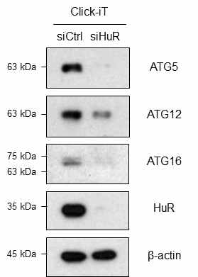 Click-iT 실험을 통해 HuR 발현 감소에 따른 ATG5, ATG12, ATG16의 번역 억제 확인