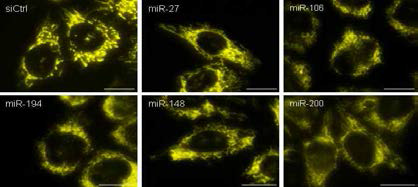 miRNA 조절에 따른 미토콘드리아 형태학적 변화 관찰
