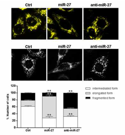 miR-27 발현 조절에 따른 미토콘드리아 길이 변화 현미경 관찰