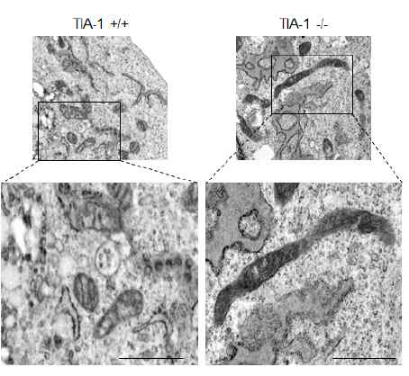 전자현미경을 이용하여 TIA-1 발현 차이에 의한 미토콘드리 아 형태학적 변화 관찰