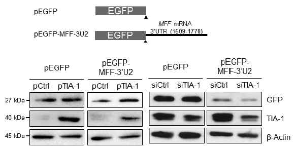 Reporter system을 이용하여 TIA-1에 의한 MFF 발현을 규명