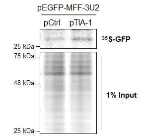 TIA-1에 의한 표적단백질의 전사 후 번역과정 조절 검증