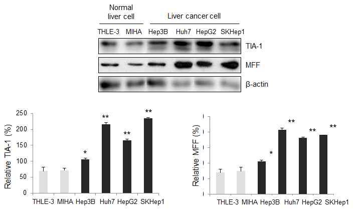 간암 세포를 이용한 TIA-1과 MFF 발현 변화 검증