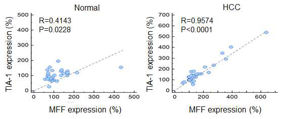 간암 조직에서의 TIA-1과 MFF 단백질의 상관관계 검증