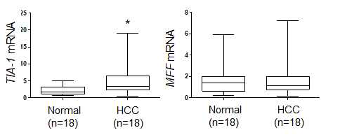 간암 조직에서의 TIA-1과 MFF mRNA 발현 검증