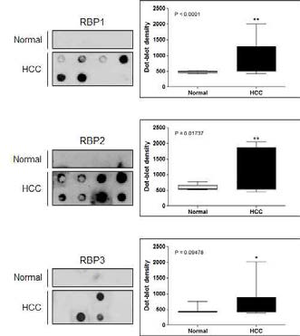 간암 혈청에서의 후보 RNA 결합 단백질 검출 확인