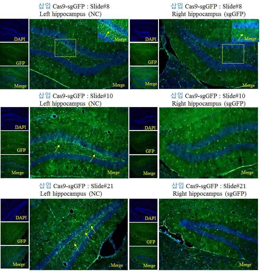 Hippocampus로 삽입/sgGFP 렌티바이러스 주사 후 형광관찰