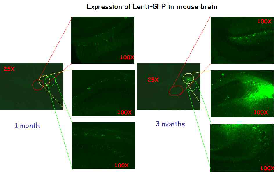 Expression of Lentivirus in mouse brain Hippocampus