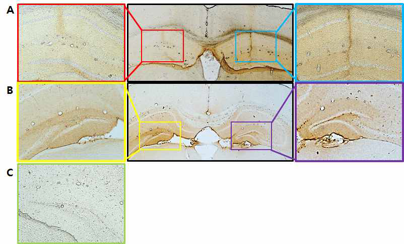 IHC of sgAPP-injected mouse hippocampus A and B : sgAPP 비삽입 렌티벡터가 주사된 5XFAD mouse hippocampus C : Non-injected 5XFAD mouse hippocampus