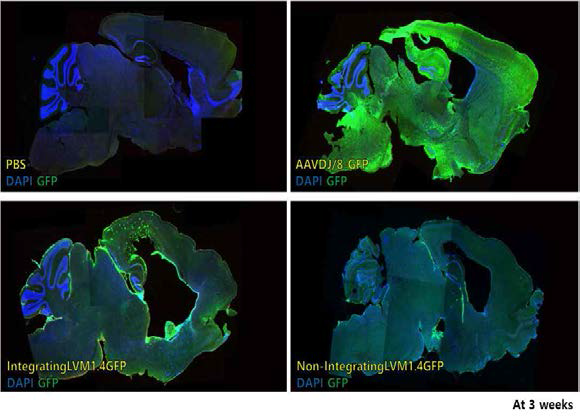 Identification of GFP expression following Intraventricular injection