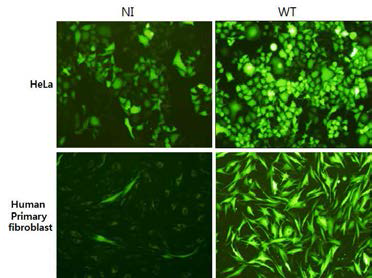 Lentivirus Concentration by ultracentrifugation