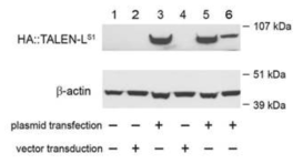 TALEN protein detection. HA tag-directed western blot analysis of full-length TALEN-LS1 expression in 293T producer cells