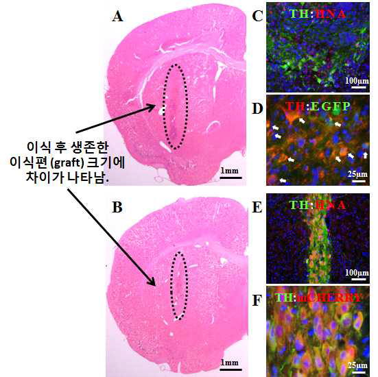 중뇌 도파민 전구세포인 LMX1A 양성세포 이식 16주 후의 생존하는 이식편 (graft)의 크기를 확인할 수 있음 (A). 중뇌 도파민 신경세포인 PITX3 양성세포 이식 16주 후의 생존하는 이식편 (graft)의 크기를 LMX1A 양성세포 이식 후 조직 크기와 비교할 수 있음 (B). LMX1A 양성세포 이식 조직에서 인간세포 마커인 HNA 양성인 세포가 TH를 발현하는 성숙한 도파민 신경세포로 분화하였음을 확인함 (C). 이식한 LMX1A 양성세포 (EGFP 양성세포)가 TH를 발현하는 성숙한 도파민 신경세포로 분화하였음을 확인함 (D). PITX3 양성세포 이식 조직에서 인간세포 마커인 HNA 양성인 세포가 TH를 발현하는 성숙한 도파민 세포임을 확인함 (E). 이식한 PITX3 양성 이식세포 (mCherry 양성세포)가 TH를 발현하는 성숙한 도파민 신경세포임을 확인함 (F)