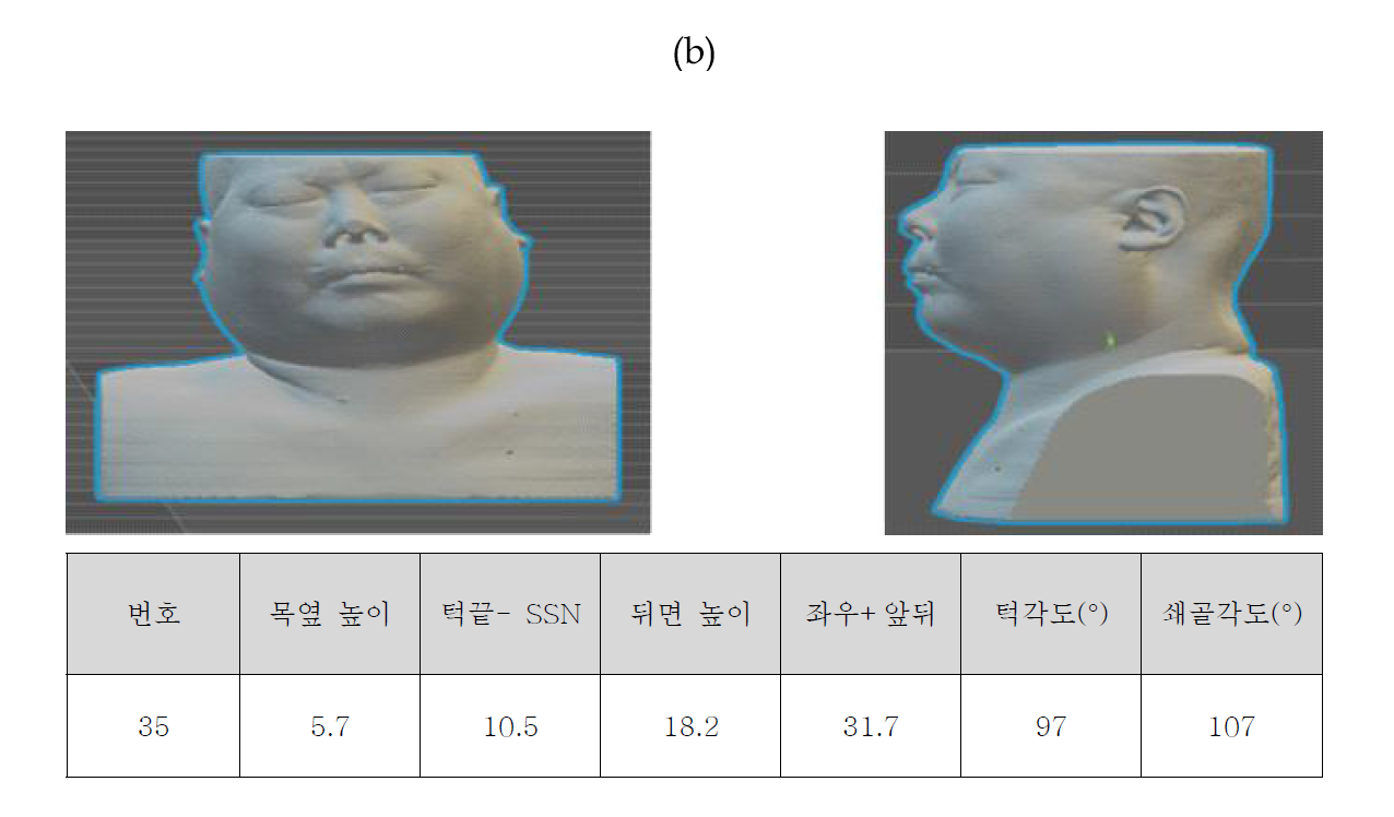 경추보호대 제작을 위한 모델 선정 (b)목이 짧고 굵은 모델