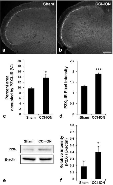 신경 손상 만성 통증 모델(CCI-ION)에서의 P2X3 발현 변화. a-d) Immunohistochemistry 결과, P2X3가 CCI-ION rat의 Vc에서 증가함을 확인하였음. e, f) Western blot 결과 CCI-ION의 Vc에서 P2X3가 증가하였음을 확인하였음