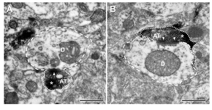 생쥐의 CVLM 내의 TRPM8(A) 및 TRPV1(B) 양성 축색종말의 전자현미경 사진. AT: 축색종말, D: 수상돌기, 화살표머리: 신경연접, 별표: 면역양성반응. 축척 500 nm