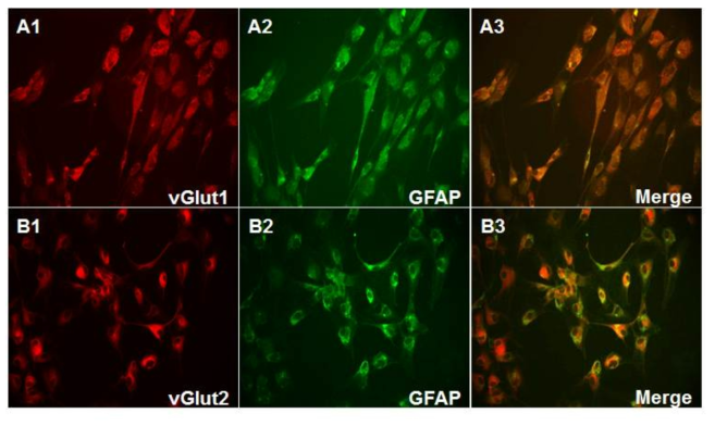 삼차신경절 내 SGCs에서의 vGlut1 및 vGlut2 발현 확인