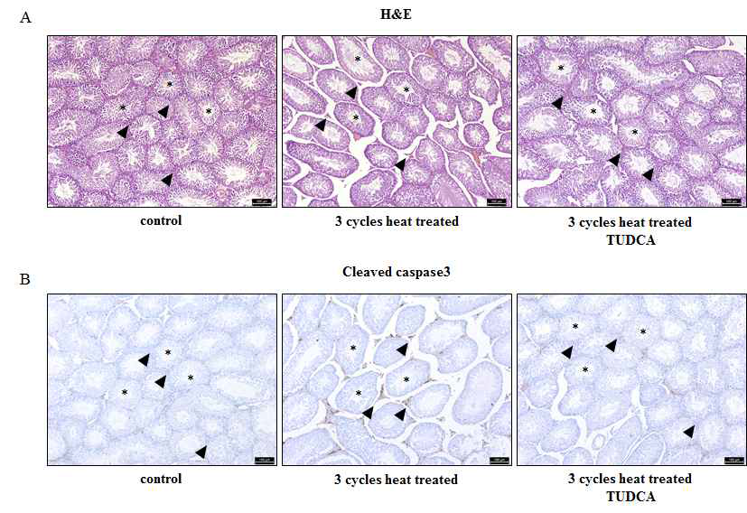 정소에 열 처리후 관찰한 결과 세포사멸이 증가하였으나, TUDCA에 의해 회복됨
