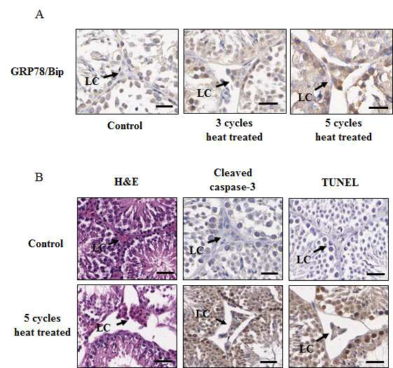 정소에 열 충격은 라이디히세포의 GRP78/Bip발현과 세포사멸을 증가시킴