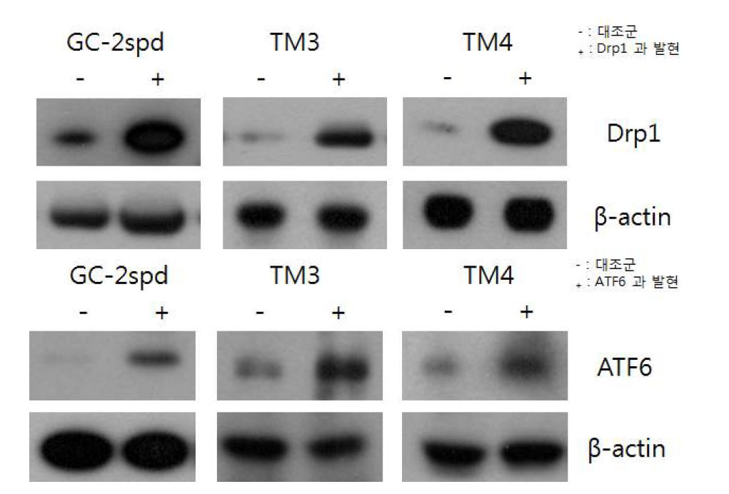 GC-2spd, TM3, TM4 세포 주에 각각 Drp1과 ATF6를 렌티바이러스를 통해 발현 시킨 후 웨스턴 블로팅을 통해 발현을 확인