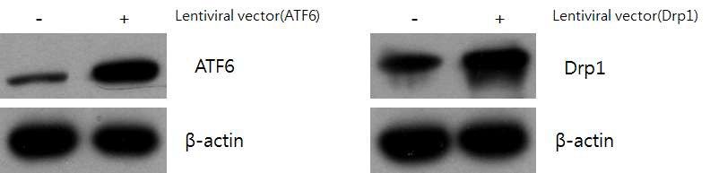 렌티바이러스를 주입한 정소로부터 추출한 단백질에서 Drp1과 ATF6의 발현을 검증