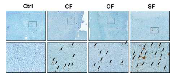 orthotopic 간암 종양마우스의 종양에 다양한 프로토콜의 방사선 조사 7일 TUNEL stain. →, TUNEL positive (apoptosis)