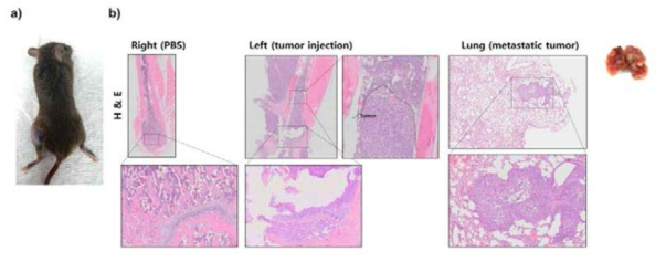 종양 세포 주입 4주 후 (a) 대퇴부 종양성장과 (b) H&E stain 결과 femur 및 lung에 metastatic tumor 관찰됨