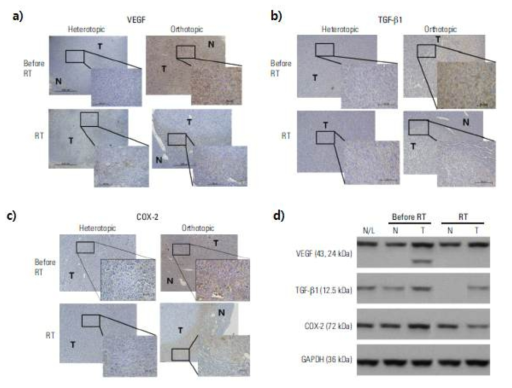 간암 heterotopic/ orthotopic 모델에서 방사선에 의한 VEGF (a), TGF-β1 (b), COX-2 (c) IHC 및 western blot (d)