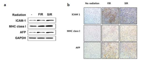 간암세포 (a)와 heterotopic 모델에서 (b) 에서 방사선 조사에 의한 ICAM-1, MHC class 1 및 AFP 발현 변화