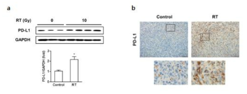 Heterotopic 모델에서 방사선 조사에 의한 종양내 PD-L1 western blot (A) 및 IHC (B)