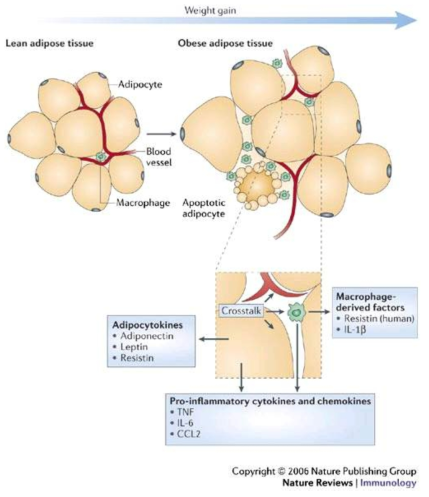 지방 대식세포의 염증 작용과 비만과의 관계