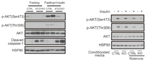 A. 일반생쥐와 Atg7 knockout 생쥐의 지방조직에서의 인슐린 신호, B. 일반생쥐와 Atg7 knockout 생쥐로부터 얻은 대식세포의 conditional media에 의한 인슐린 신호 억제 비교