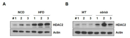(A) 고지방식이를 먹인 마우스 및 (B) ob/ob 마우스 간 조직에서 HDAC1의 발현이 증가되어 있음