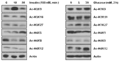 간세포에서 인슐린 양과 당의 수치에 따라 변화하는 히스톤 H3, H4의 acetylation 상태