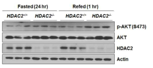 고지방식이 섭취 후, HDAC2 유전자 결핍에 의한 간 내 AKT 인산화 증가