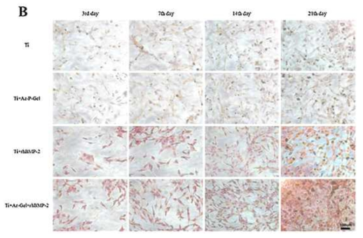 다양한 티타늄 표면개질에 대한 Alizarin Red staining 결과