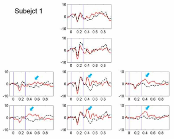 정상인 피험자 1명의 ERP 파형 (y-axis = amplitude (uV), x-axis = time (sec))