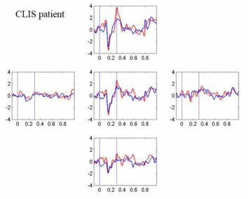 CLIS 환자 1명의 ERP 파형 (y-axis = amplitude (uV), x-axis = time (sec))