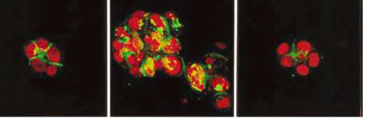 3차원 배양에서 유방암세포(왼쪽)가 악성세포(중앙)가 된 후 β-integrin-항체를 배양 시스템에 투여 후 원래의 상태(오른쪽)로 되돌아감을 보여줌(Nature, 2003)