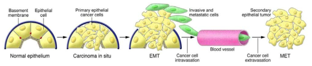 상피암세포의 간엽 전환(EMT)이 암세포 전이 및 악성 암 진화에 기여함(J Clin Invest, 2014)