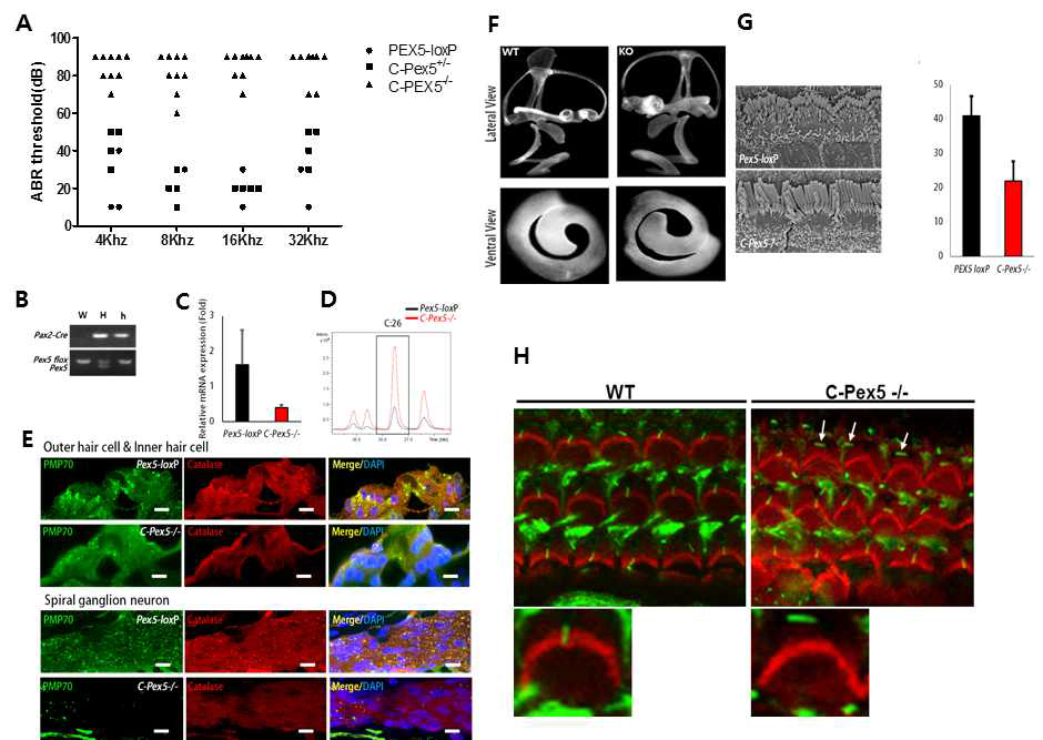 Pex5 deficiency induces hearing loss and peroxisome damage