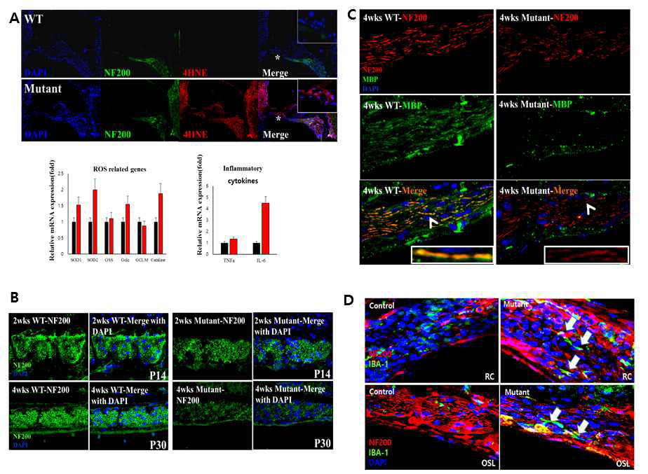 Pex5 deficiency induces ROS, inflammation related gene expression and the damage of spiral ganglion neuron