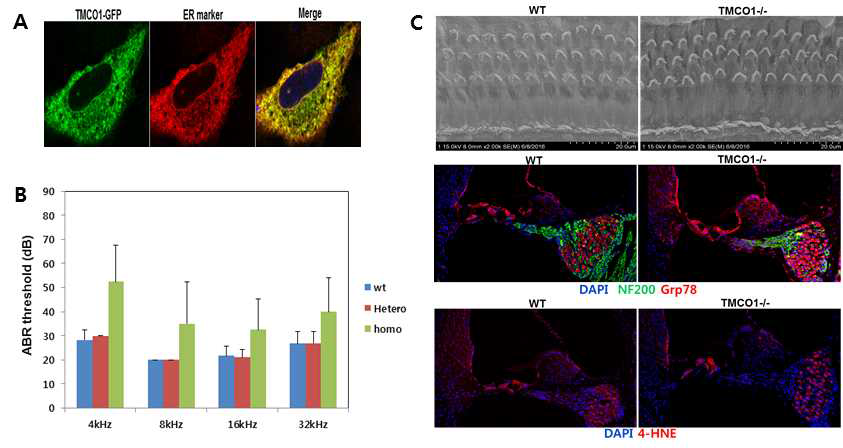 The localization of TMCO1 in ER and the effect of TMCO1 deficiency on hearing function