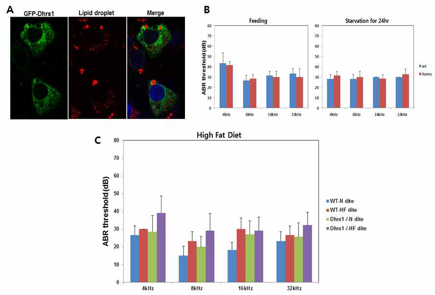 Dhrs1 is localized in LD in auditory cell lines and the effect of Dhrs1 deficiency on hearing function by high fat diet (HFD)