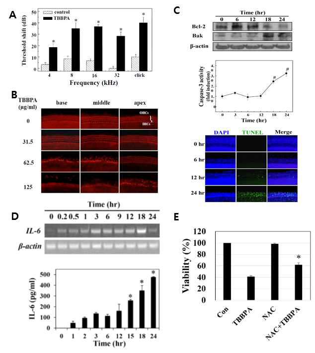 TBBPA induced hearing loss and hair cell death through ROS accumulation