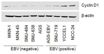 EBV 음성 및 양성 위암 세포주에서 Cyclin D1 발현 패턴 분석